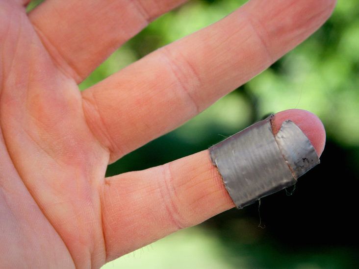 The Best Duct Tape for Wart Removal