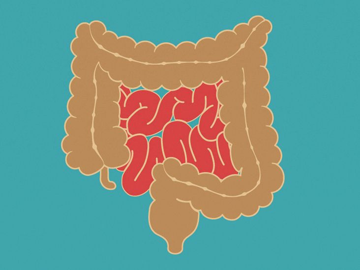 Small Intestine Cancer Symptoms Types And Treatment