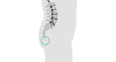 Causes, Symptoms and Treatment Options for Tailbone Pain - MVM Health - Pain,  Vein & Wellness