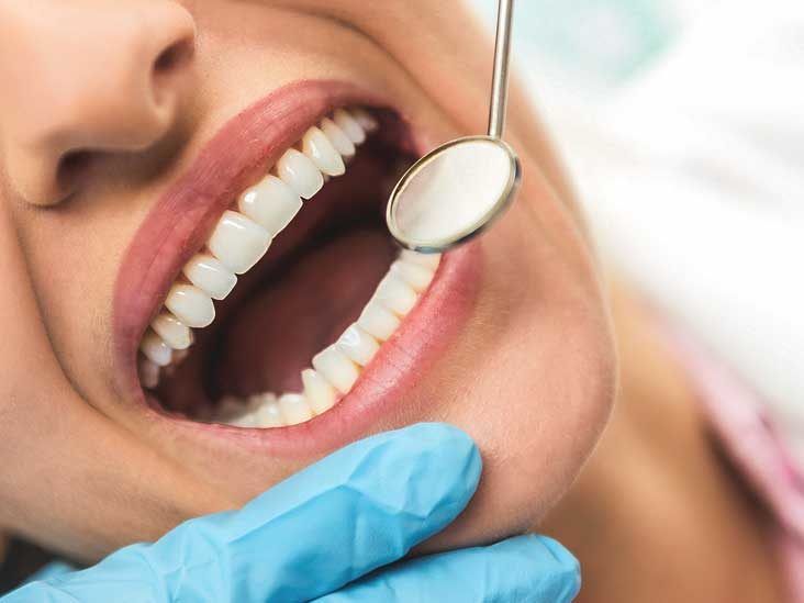 Tooth Repair Kit-Temporary Fixing Irregular & Deformity Teeth or Missing  and Broken Tooth Fake Teeth with Instant Snapping Veneers Smile Adhesive  The Denture Fake Teeth