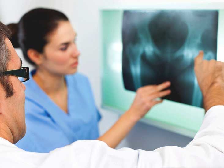 Anterior Hip Replacement: Benefits, Risks, Outlook & What to Expect