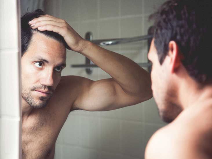 What Causes Hair Loss in Men and How to Treat it