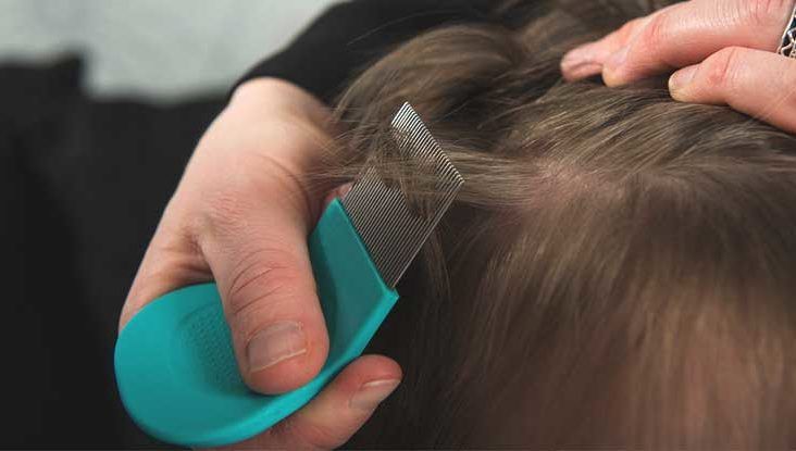 Top 129+ hair lice treatment at home best