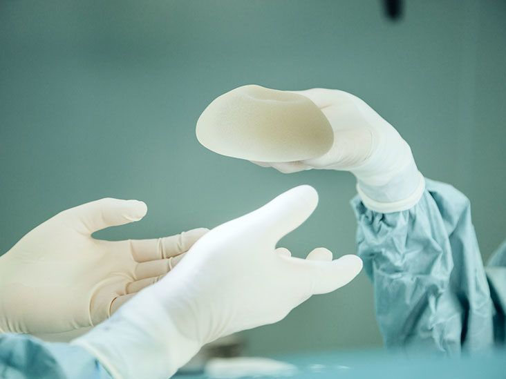 Breast Implant Illness: Safety, Symptoms, Treatments, and More