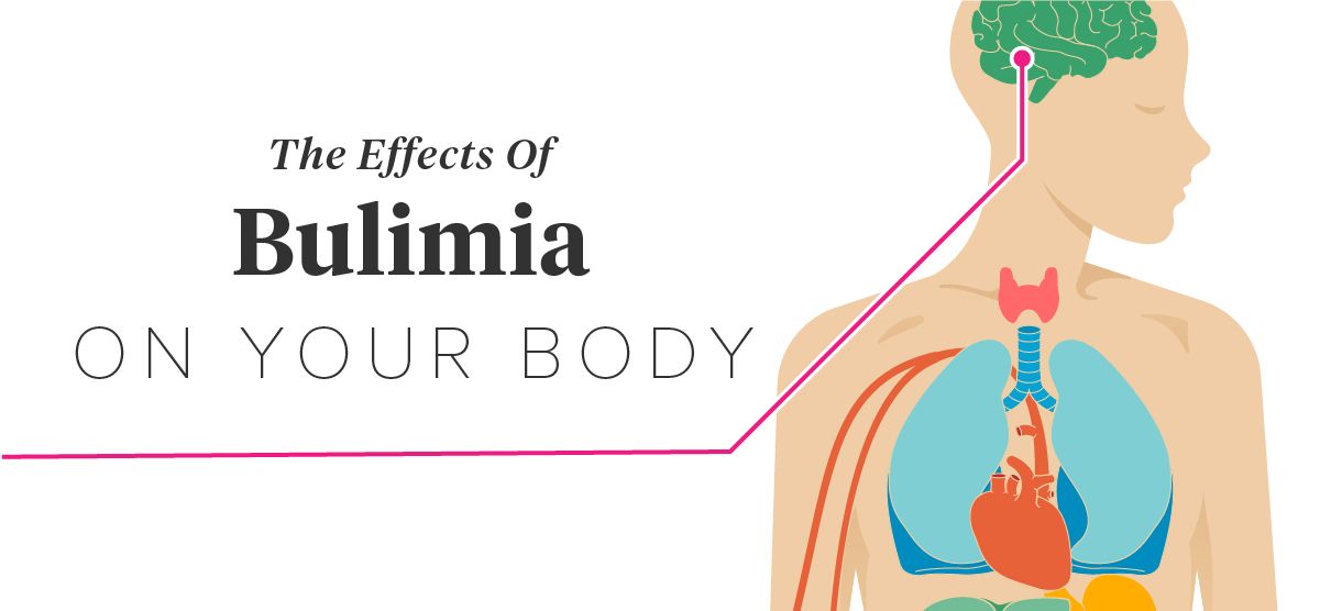 bulimia effects on body