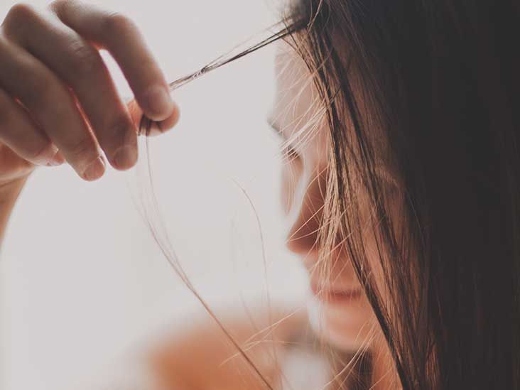 Lupus Hair Loss Pictures, Symptoms, Treatment, Prevention, and More