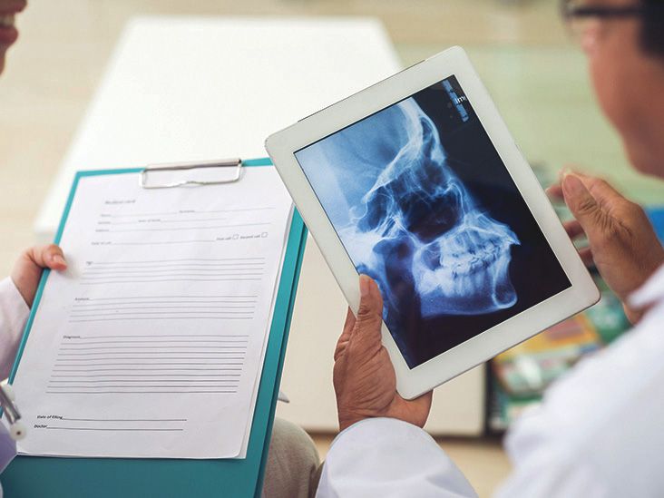 Jaw Wired Shut Benefits, Tips, and Foods