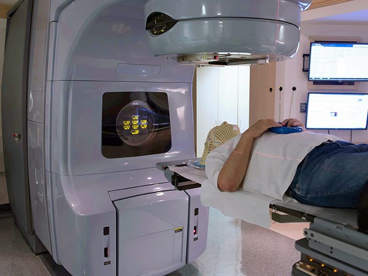 Your Guide to Radiation Therapy for Tongue Cancer