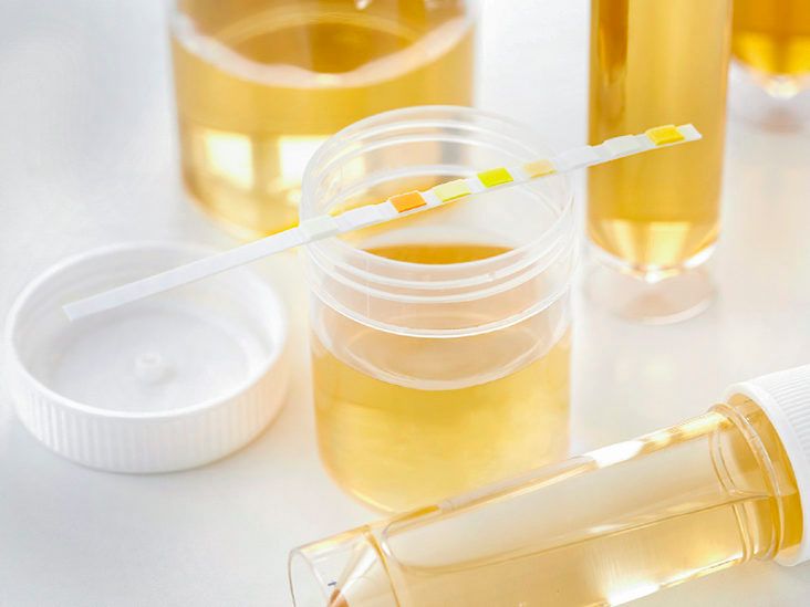 Urine Color Chart: What's Normal and When to See a Doctor