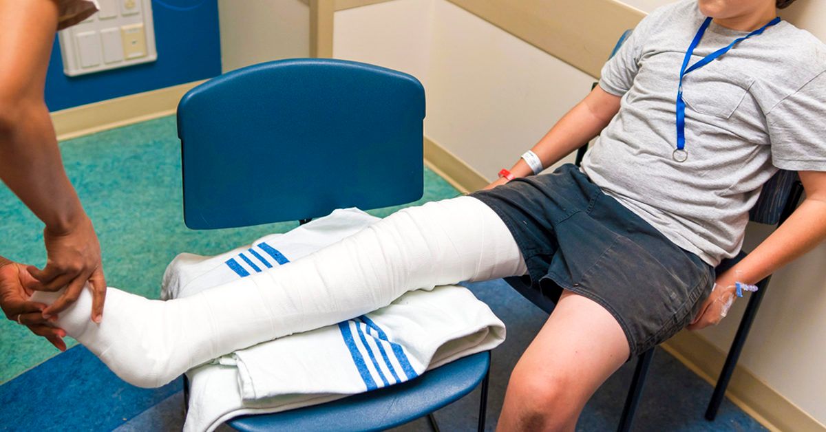 Broken Femur: Causes, Treatment, and Complications