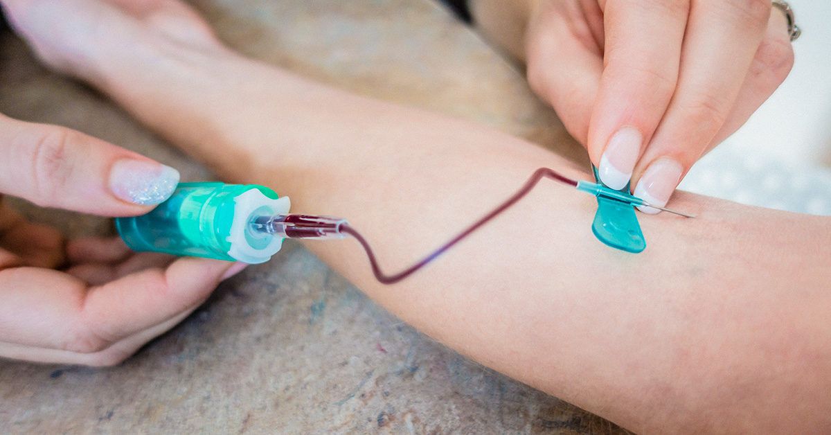 Butterfly Needle for Blood Draw How It Works and Why It’s Used