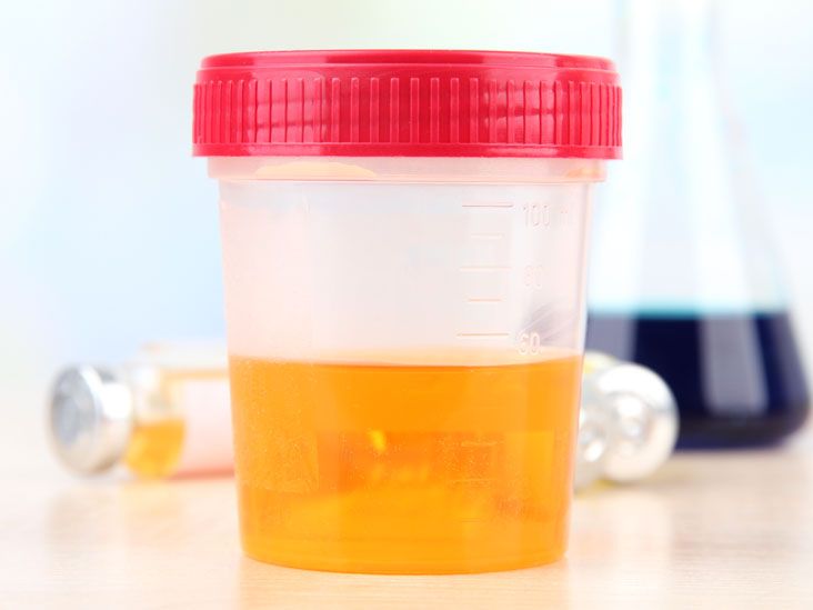 Catecholamine Urine Test Purpose, Preparation, and Procedure