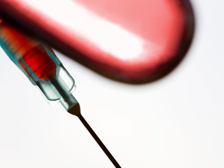 Chloride Blood Test Procedure, Risks, and Results