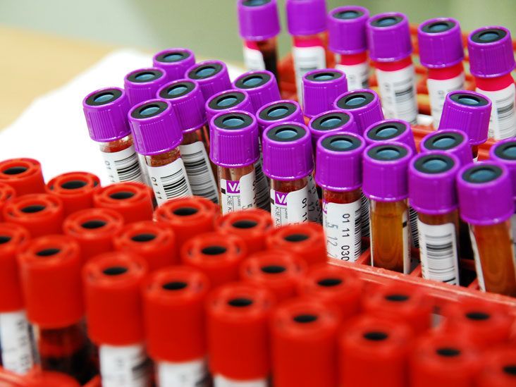 What does high ESR blood test mean? - Cura4U