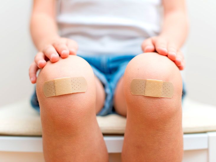 How to Bandage a Wound During First Aid: Stopping Bleeding, Infection