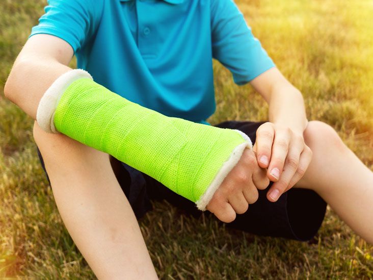 Fracture | definition and patient education