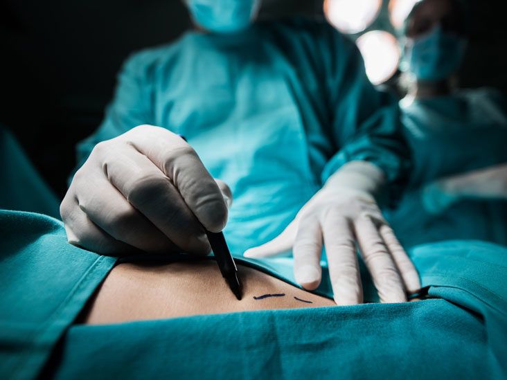 From dodgy filler to a near-fatal tummy tuck — plastic surgery ruined our  lives – The US Sun