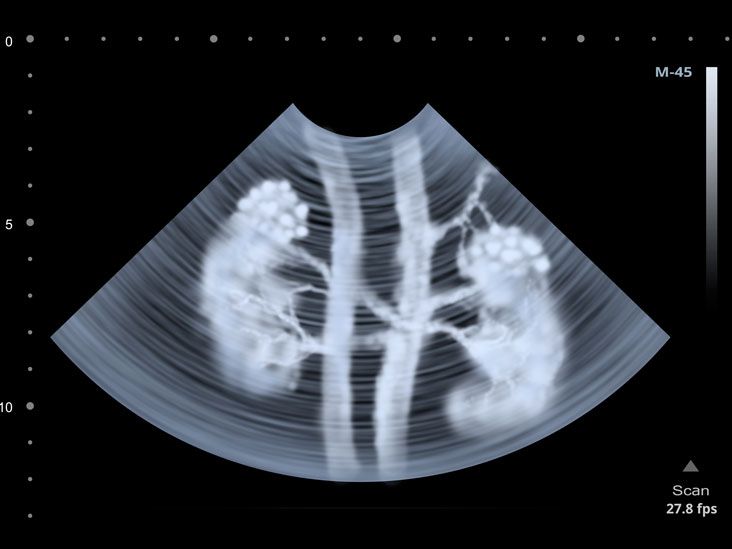 The X-ray scanner is used to investigate a discrepancy in sex