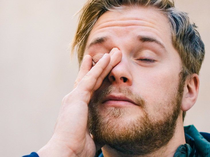 10+ expert tips that will get rid of puffy eyes