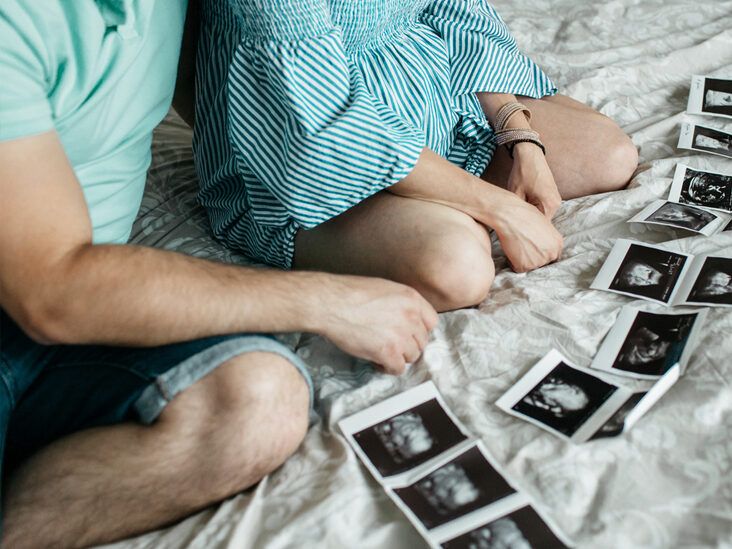 How Soon Can You Get Pregnant After Having Your IUD Removed?