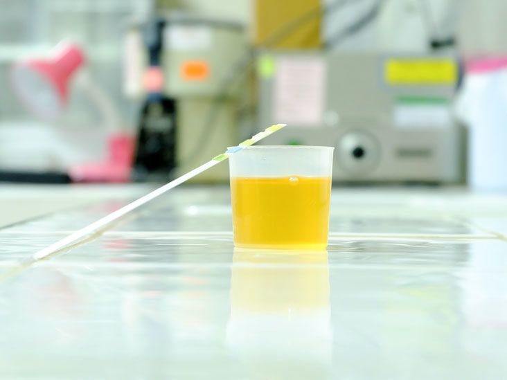 Close Up View To Test Tube with Urine and Blood Sticking Out from