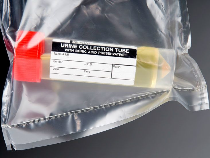Urine Drug Test: Purpose, Types, and Procedure