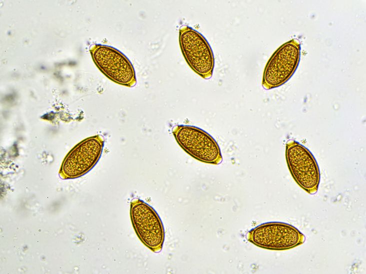 Whipworm Infection: Symptoms, Causes, Treatment, and Prevention