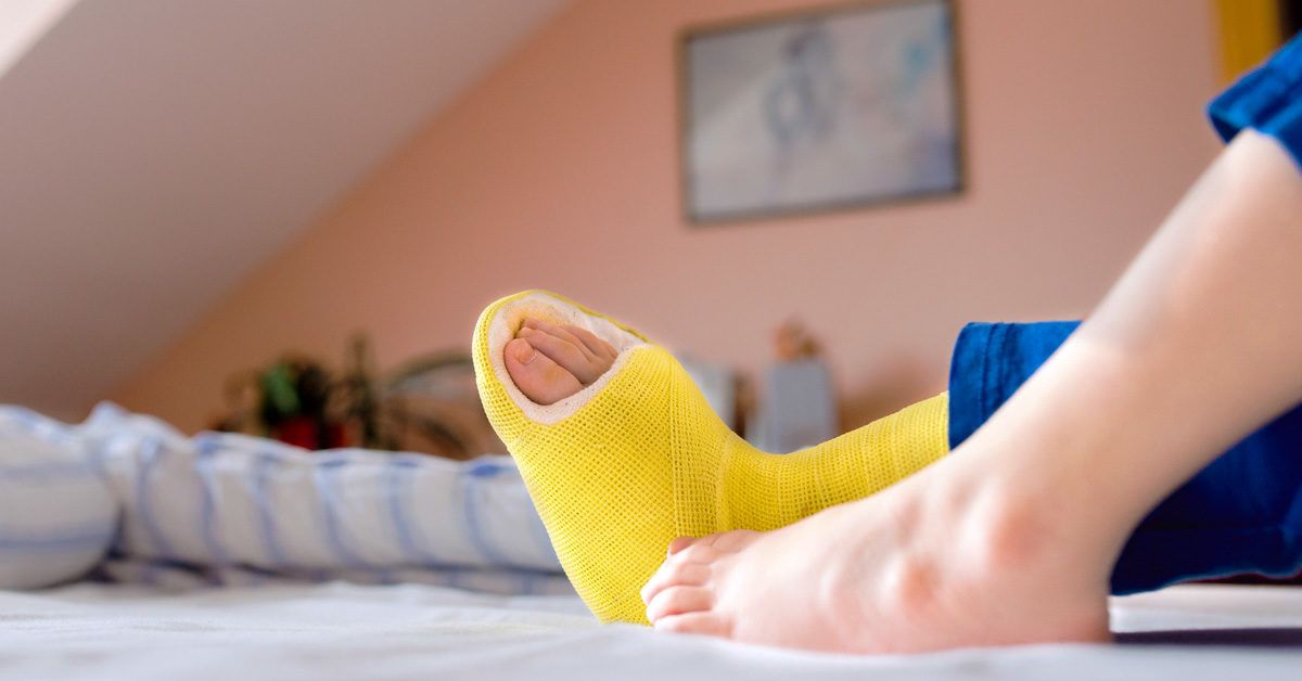 The Truth About Fiberglass Casts for Bone Fractures