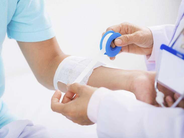 The Best Treatments for Severe Eczema