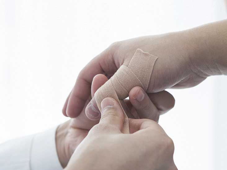 Sprained Thumb: Treatment, Recovery, Symptoms, And More