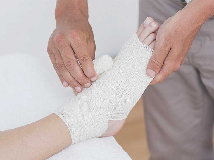 Care of Casts and Splints - OrthoInfo - AAOS