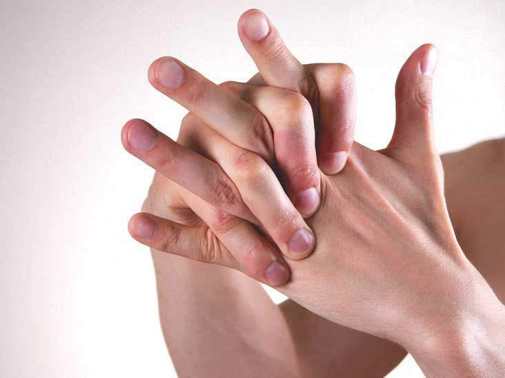 Webbing of the Fingers: Causes and Treatments