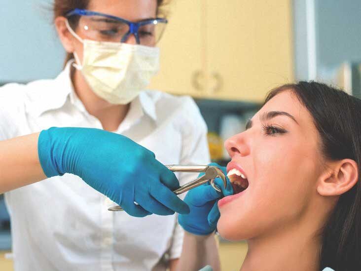 How to Prevent Dry Socket After Tooth Extraction: 6 Tips