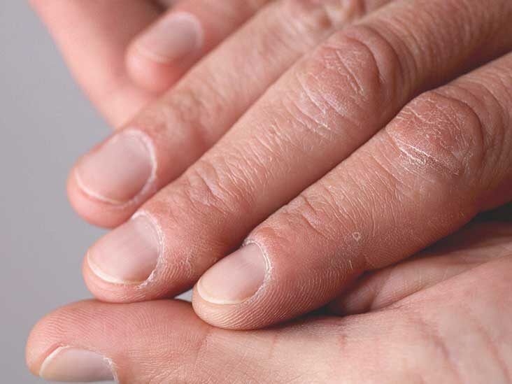 Neroli Salon & Spa | Hand Relief for Overwashing