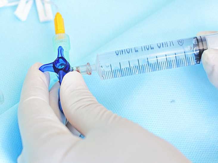 Ommaya Reservoir Placement, Removal, Safety, and Complications