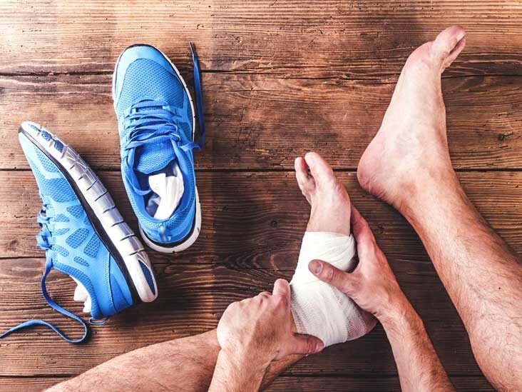 Ankle Sprain: Causes, Symptoms, and Diagnosis