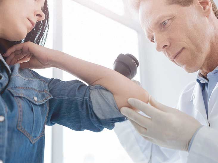 Pityriasis Rosea (Christmas Tree Rash) Pictures, Causes