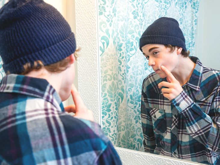 Does Masturbation Cause Acne? Causes, Treatment, and More