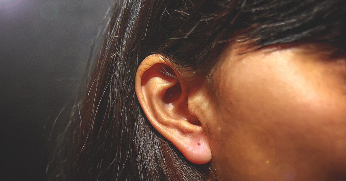 plaque psoriasis ear