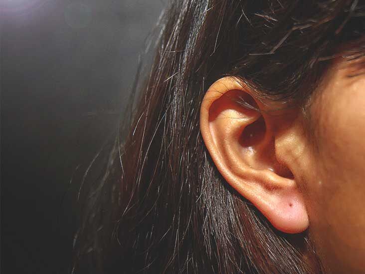 Psoriasis in Your Ears: Symptoms, Pictures, Treatment, and More