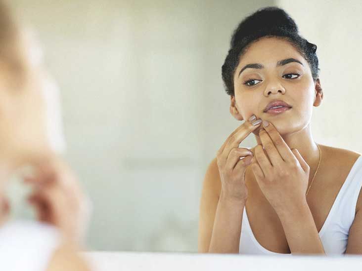 Jawline Acne Causes, Treatment, and More