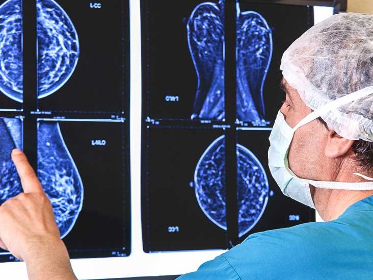 Mammogram images: Normal, abnormal, and breast cancer