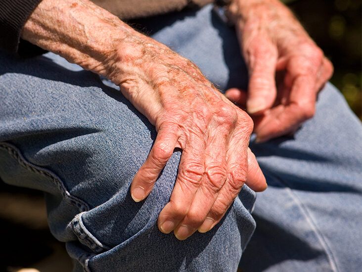 Arthritis: Symptoms, Causes, Types, Treatment & Prevention