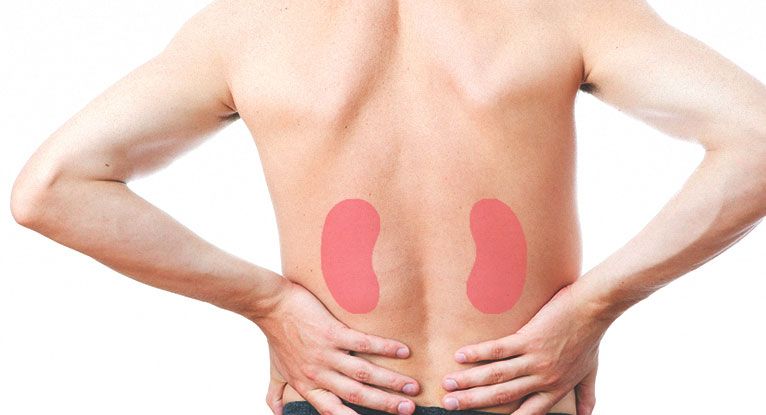 Diabetic Nephropathy: Symptoms, Outlook, and More