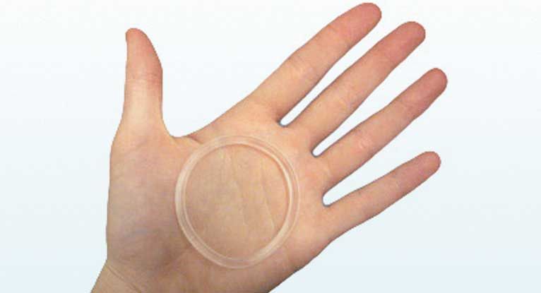 Vaginal Ring for Birth Control