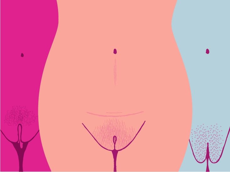 When Does Pubic Fat Pad Go Away? Explained