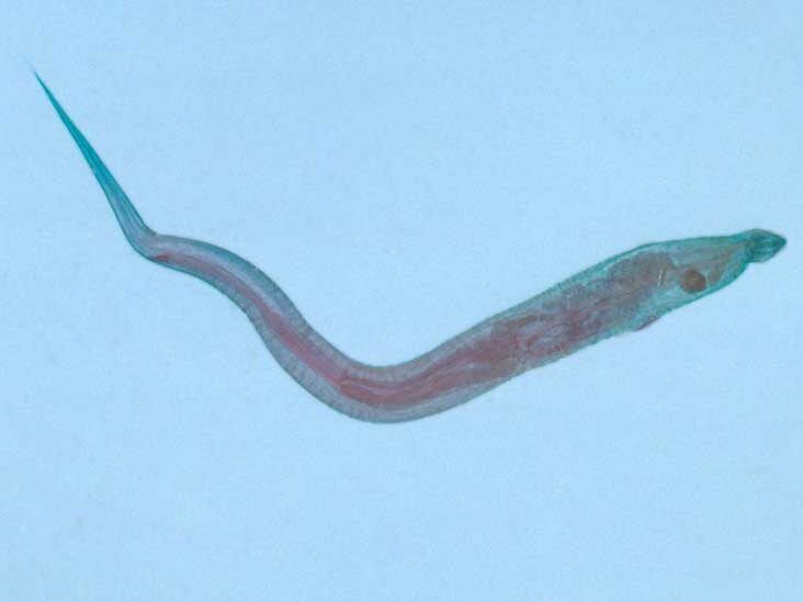 parasite in intestines