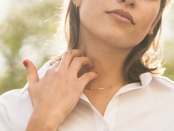 Itchy Neck: Symptoms, Causes, and Treatment