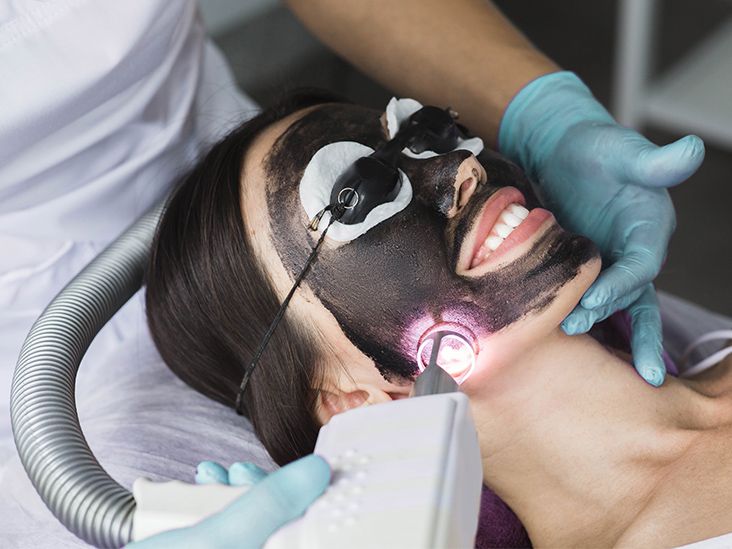 Everything You Need To Know About Laser Carbon Peels