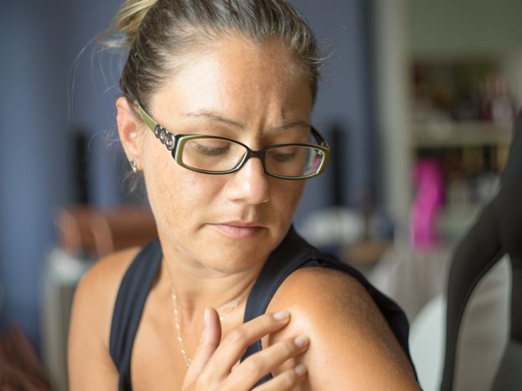 Metastatic melanoma: symptoms, treatment, outlook
